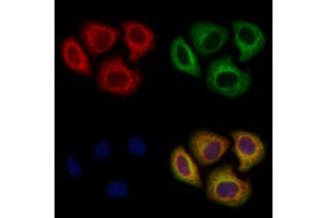 ABIN6265879 and ABIN6278541 staining Hela cells by IF/ICC. (UGT8 抗体  (Internal Region))
