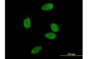 Immunofluorescence of monoclonal antibody to NR0B2 on HeLa cell. (NR0B2 抗体  (AA 1-257))