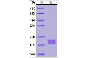 SDS-PAGE (SDS) image for CD274 (PD-L1) (AA 19-134) (Active) protein (His tag,AVI tag,Biotin) (ABIN6950994)