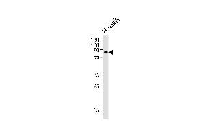 Western blot analysis of lysate from human testis tissue lysate, using ZIM2 Antibody (N-term) (ABIN6244190 and ABIN6577604). (ZIM2 抗体  (N-Term))