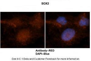 Immunohistochemistry (IHC) image for anti-SRY (Sex Determining Region Y)-Box 2 (SOX2) (Middle Region) antibody (ABIN2780468)