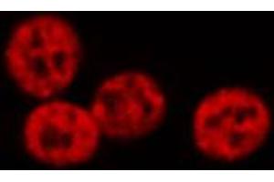 ABIN6274223 staining Hela cells by IF/ICC. (GTF2E2 抗体  (Internal Region))