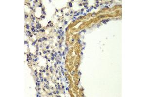 Immunohistochemistry (IHC) image for anti-Protein Kinase, CGMP-Dependent, Type I (PRKG1) (AA 1-300) antibody (ABIN3016256) (PRKG1 抗体  (AA 1-300))