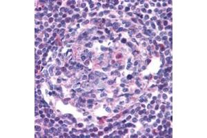 Image no. 1 for anti-Chemokine (C-C Motif) Receptor 5 (CCR5) (AA 6-20) antibody (ABIN319017)