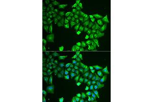 Immunofluorescence analysis of HeLa cells using ASL antibody (ABIN5973767). (ASL 抗体)