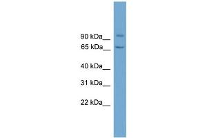 WB Suggested Anti-LOH11CR2A Antibody Titration: 0. (VWA5A 抗体  (N-Term))