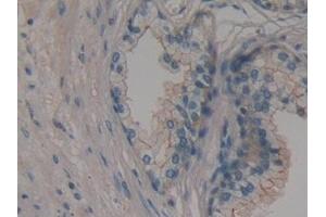 anti-Membrane Protein, Palmitoylated 6 (MAGUK P55 Subfamily Member 6) (MPP6) (AA 331-503) antibody