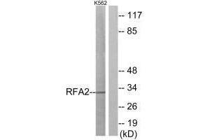 Western blot analysis of extracts from K562 cells, using RFA2 (Ab-21) antibody. (RPA2 抗体  (Thr21))