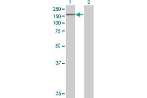 Western Blotting (WB) image for anti-Eukaryotic Translation Initiation Factor 4E Nuclear Import Factor 1 (EIF4ENIF1) (AA 1-985) antibody (ABIN527918)