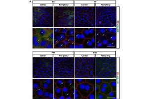 Confocal images stained for Arl13b (cat.