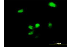 Immunofluorescence of purified MaxPab antibody to YBX2 on HeLa cell. (YBX2 抗体  (AA 1-364))