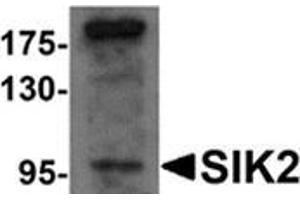 Western blot analysis of SIK2 in SW480 cell lysate with SIK2 antibody at 1 μg/ml. (SIK2 抗体  (Center))