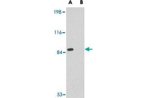 Western blot analysis of RIMS2 in rat brain tissue lysate with RIMS2 polyclonal antibody  at 1 ug/mL in the (A) absence or (B) presence of blocking peptide. (RIMS2 抗体  (Internal Region))