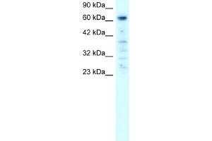 WB Suggested Anti-PAntibody Titration:  0. (PARP3 抗体  (C-Term))