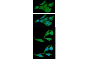 ICC/IF analysis of CRADD in HeLa cells line, stained with DAPI (Blue) for nucleus staining and monoclonal anti-human CRADD antibody (1:100) with goat anti-mouse IgG-Alexa fluor 488 conjugate (Green). (CRADD 抗体)