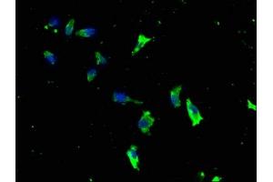 Immunofluorescence staining of SH-SY5Y cells with ABIN7157554 at 1:133, counter-stained with DAPI. (KSR1 抗体  (AA 404-598))