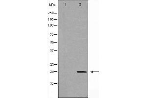 Western blot analysis of Hela cell lysate, using RAMP2 Antibody. (RAMP2 抗体  (Internal Region))