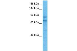 Western Blotting (WB) image for anti-Periostin (POSTN) (Middle Region) antibody (ABIN2776883)