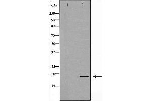 Western blot analysis of Hela whole cell lysates, using UBE2C Antibody. (UBE2C 抗体  (C-Term))