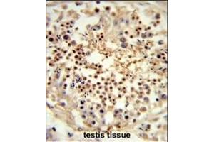 Formalin-fixed and paraffin-embedded human testis tissue reacted with UN Antibody (Center) (ABIN653320 and ABIN2842812) , which was peroxidase-conjugated to the secondary antibody, followed by DAB staining. (UNC119 抗体  (AA 64-94))