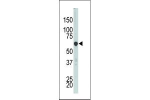 The anti-PCTK3 Pab (ABIN391790 and ABIN2841646) is used in Western blot to detect PCTK3 in HL-60 cell lysate. (CDK18 抗体  (N-Term))