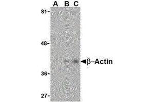 Western Blotting (WB) image for anti-Actin, beta (ACTB) (N-Term) antibody (ABIN2477265) (beta Actin 抗体  (N-Term))