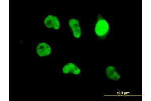 Immunofluorescence of monoclonal antibody to ZBED1 on HeLa cell. (ZBED1 抗体  (AA 3-99))