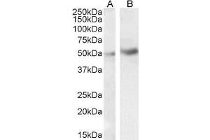 ABIN185338 (1µg/ml) staining of HeLa (A) and Jurkat (B) cell lysate (35µg protein in RIPA buffer).