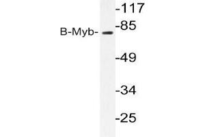 Western blot analysis of B-Myb antibody in extracts from K562 cells. (MYBL2 抗体)