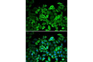 Immunofluorescence analysis of HeLa cells using ANXA1 antibody. (Annexin a1 抗体)