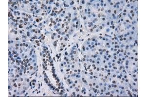 Immunohistochemical staining of paraffin-embedded colon tissue using anti-FKBP5mouse monoclonal antibody. (FKBP5 抗体)