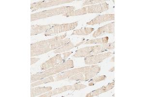 Immunohistochemistry (Paraffin-embedded Sections) (IHC (p)) image for anti-Phosphoinositide 3 Kinase, p85 alpha (PI3K p85a) (AA 1-30), (N-Term) antibody (ABIN392570)