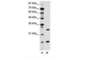 Image no. 1 for anti-CCAAT/enhancer Binding Protein (C/EBP), gamma (CEBPG) (AA 11-60) antibody (ABIN6736115) (CEBPG 抗体  (AA 11-60))