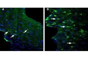 Expression of GPR84 in mouse fornix in a kainic acid-induced model of temporal lobe epilepsy - Immunohistochemical staining of perfusion-fixed frozen mouse brain sections with Anti-GPR84 (extracellular) Antibody (ABIN7043175, ABIN7044443 and ABIN7044444), (1:200), followed by goat anti-rabbit-AlexaFluor-488. (GPR84 抗体  (Extracellular))