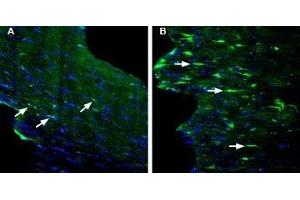 Expression of GPR84 in mouse fornix in a kainic acid-induced model of temporal lobe epilepsy - Immunohistochemical staining of perfusion-fixed frozen mouse brain sections with Anti-GPR84 (extracellular) Antibody (ABIN7043175, ABIN7044443 and ABIN7044444), (1:200), followed by goat anti-rabbit-AlexaFluor-488. (GPR84 抗体  (2nd Extracellular Loop))