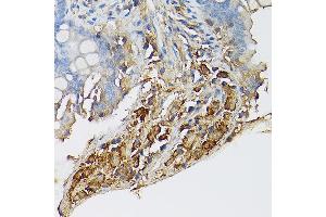 Immunohistochemistry (IHC) image for anti-Mast/stem Cell Growth Factor Receptor (KIT) (AA 25-295) antibody (ABIN6142896)