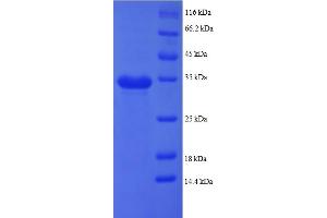 SDS-PAGE (SDS) image for Pro-Platelet Basic Protein (Chemokine (C-X-C Motif) Ligand 7) (PPBP) (AA 59-125), (partial) protein (GST tag) (ABIN5712648) (CXCL7 Protein (AA 59-125, partial) (GST tag))