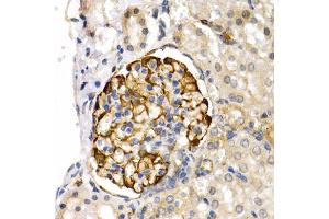 Immunohistochemistry of paraffin-embedded rat kidney using LIPG antibody (ABIN5975340) at dilution of 1/200 (40x lens). (LIPG 抗体)