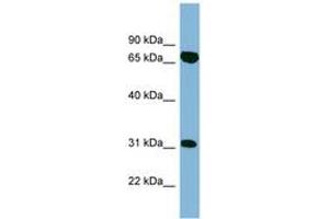 Image no. 1 for anti-HIRA Interacting Protein 3 (HIRIP3) (AA 395-444) antibody (ABIN6742134) (HIRIP3 抗体  (AA 395-444))