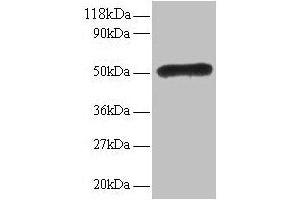 Western blot All lanes: LMO1 antibody at 2 μg/mL Lane 1: EC109 whole cell lysate Lane 2: 293T whole cell lysate Secondary Goat polyclonal to rabbit IgG at 1/15000 dilution Predicted band size: 18 kDa Observed band size: 50 kDa (LMO1 抗体  (AA 5-156))