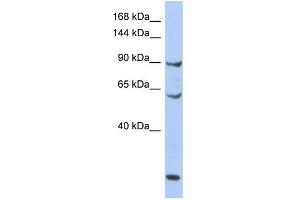 WB Suggested Anti-MCM8 Antibody Titration:  0. (MCM8 抗体  (N-Term))