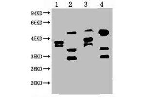 Western blot analysis of 1) Hela, 2) HepG2, 3) 293T, 4) Jurkat, diluted at 1:2000. (ERCC1 抗体)
