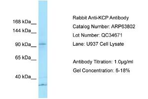 Western Blotting (WB) image for anti-Kielin/Chordin-Like Protein (KCP) (N-Term) antibody (ABIN2789631) (KCP 抗体  (N-Term))