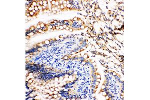 Anti-Vinculin antibody, IHC(P) IHC(P): Rat Intestine Tissue (Vinculin 抗体  (N-Term))