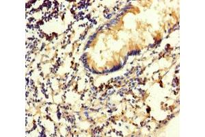 Immunohistochemistry of paraffin-embedded human appendix tissue using ABIN7170541 at dilution of 1:100 (Spermidine Synthase 抗体  (AA 17-302))