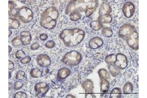 Immunoperoxidase of monoclonal antibody to OXSR1 on formalin-fixed paraffin-embedded human small Intestine. (OXSR1 抗体  (AA 1-527))