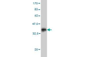 Western Blotting (WB) image for anti-Homeobox D11 (HOXD11) (AA 1-76) antibody (ABIN561358)