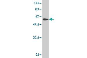 Western Blot detection against Immunogen (59. (ZNF215 抗体  (AA 1-304))