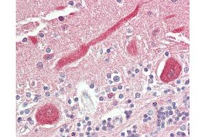 Anti-FADS1 antibody IHC staining of human brain, cerebellum. (FADS1 抗体  (AA 303-332))