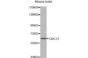 Western blot analysis of extracts of mouse testis, using CDC73 antibody (ABIN5970235). (HRPT2 抗体)
